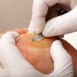 pedicure leczniczy, zabiegi podologiczne, podologia, refleksoterapia